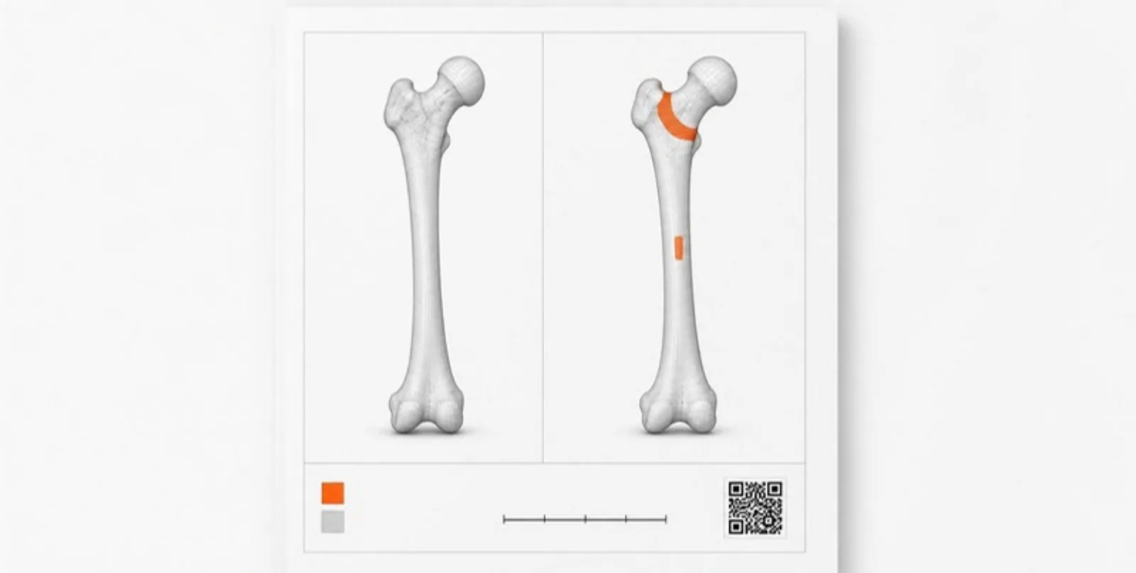 Two femur models compared side by side on a figure with legend, scale bar and QR code